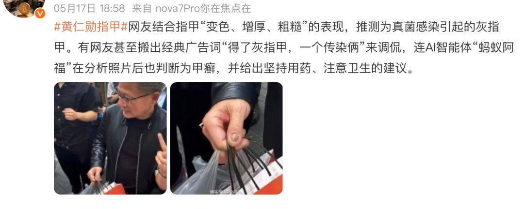 黄仁勋的指甲冲上热搜!高清镜头曝光,网友吵翻!医生:这6种情况都可能